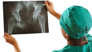 diagnóstico instrumental de la osteoartritis de la articulación de la cadera