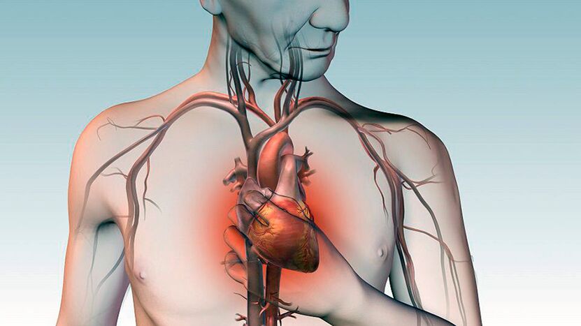 Dolor debajo del omóplato y dolor detrás del esternón en la enfermedad cardíaca