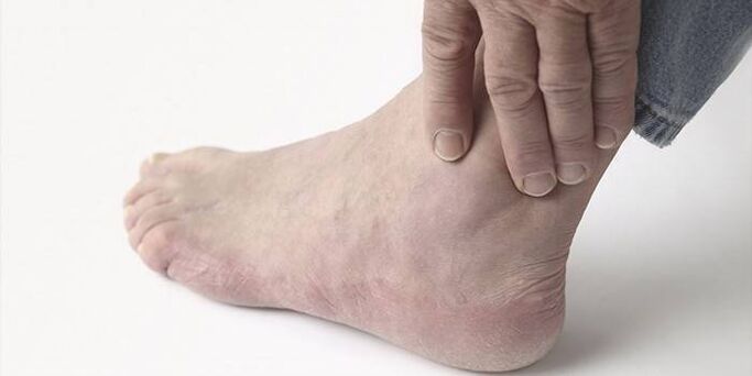 Dolor de artrosis de tobillo