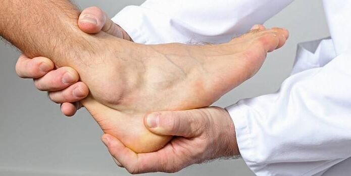 Examen especializado para la artrosis de tobillo. 