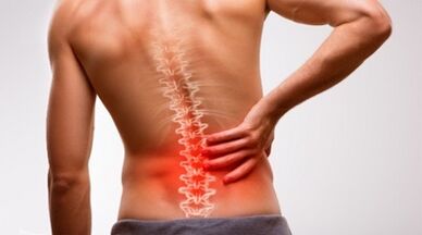 Signos y síntomas de una osteocondrosis de la columna lumbar