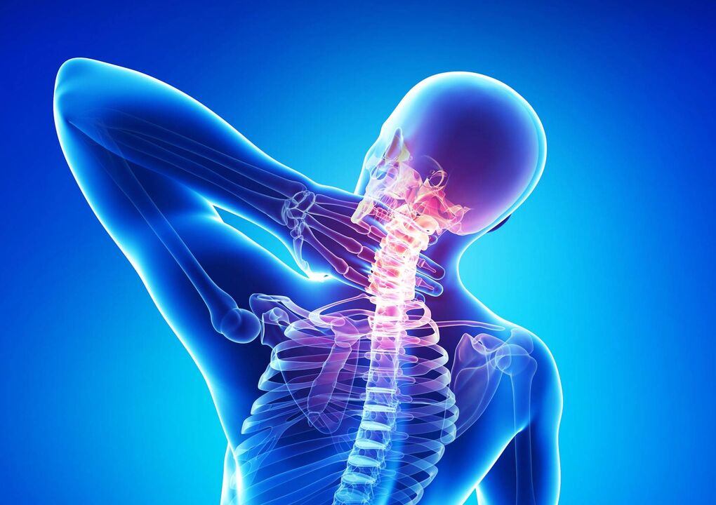 Osteocondrosis del cuello